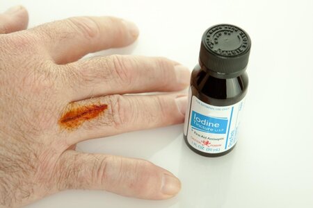 using-iodine-on-a-cut-that-may-have-an-iodine-allergy.jpg